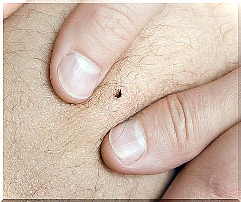 6 natural ways to get rid of ticks completely