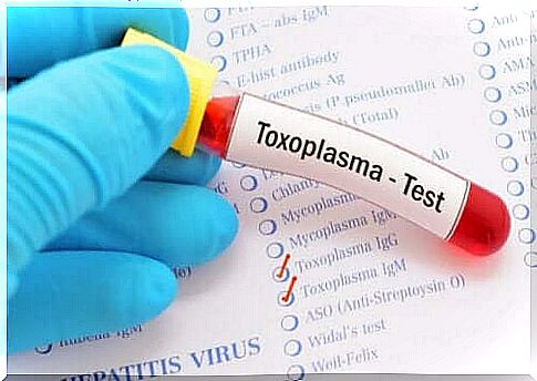 Blood test for toxoplasma