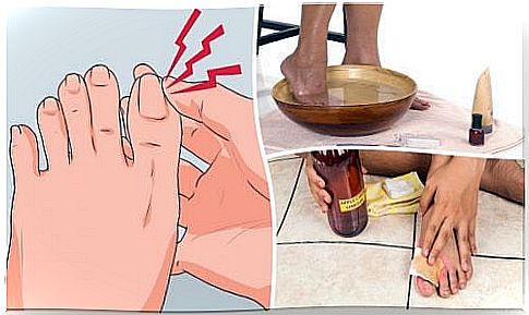 Fight ingrown toenails with these 6 home remedies