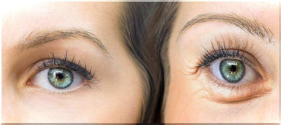 Get tight eyelids with these 5 natural ingredients