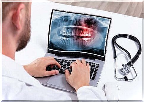 Hyperdontia - causes and treatments