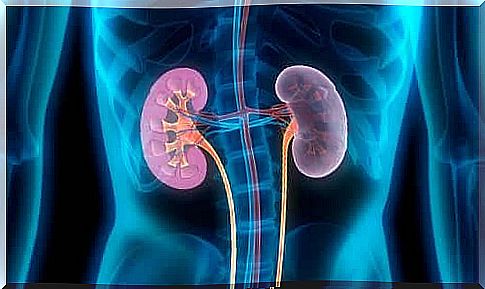 IgA nephropathy: What is it and why does it occur?