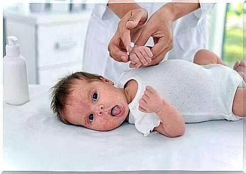 Example of caring for a newborn baby's skin