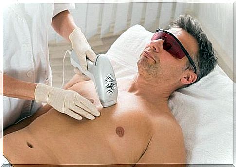 You get laser treatment