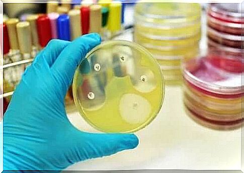 Petri dish with bacteria 