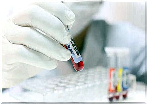 Blood tests check for hypocalcemia