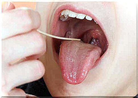 A doctor checks a child's mouth