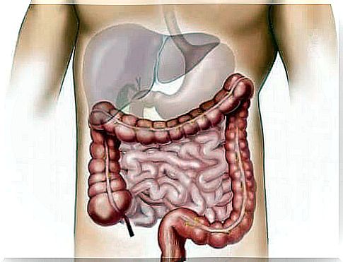 The digestive tract suffers from all sorts of conditions that can affect one's state of health, and inflammatory bowel disease (IBD) is one of them