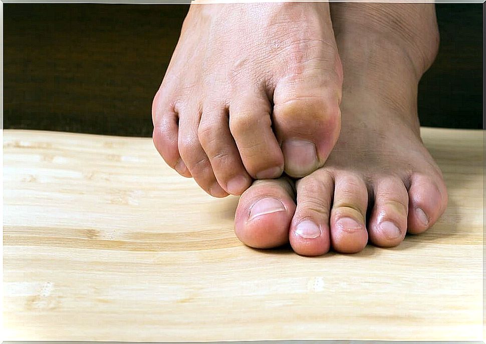 Treat your fungal infection with these remedies