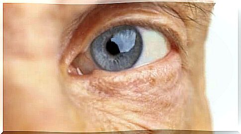 Eye illustrates age-related macular degeneration