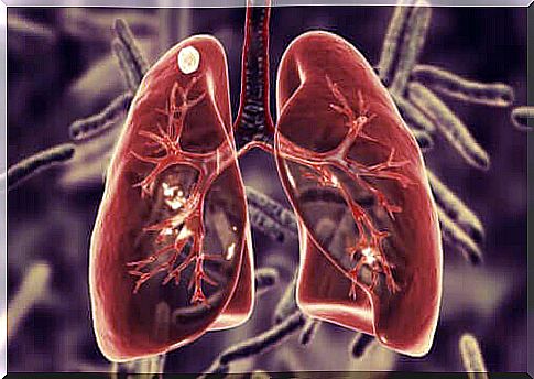 What is pulmonary tuberculosis and its symptoms?